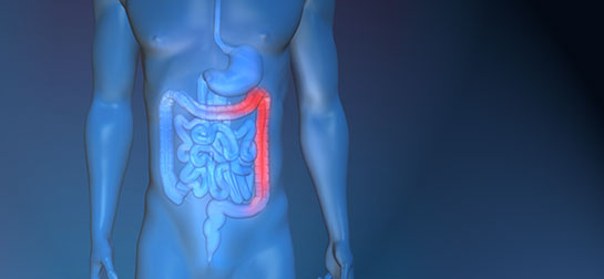 Kolon Hastalığı Belirtileri ve Tedavisi